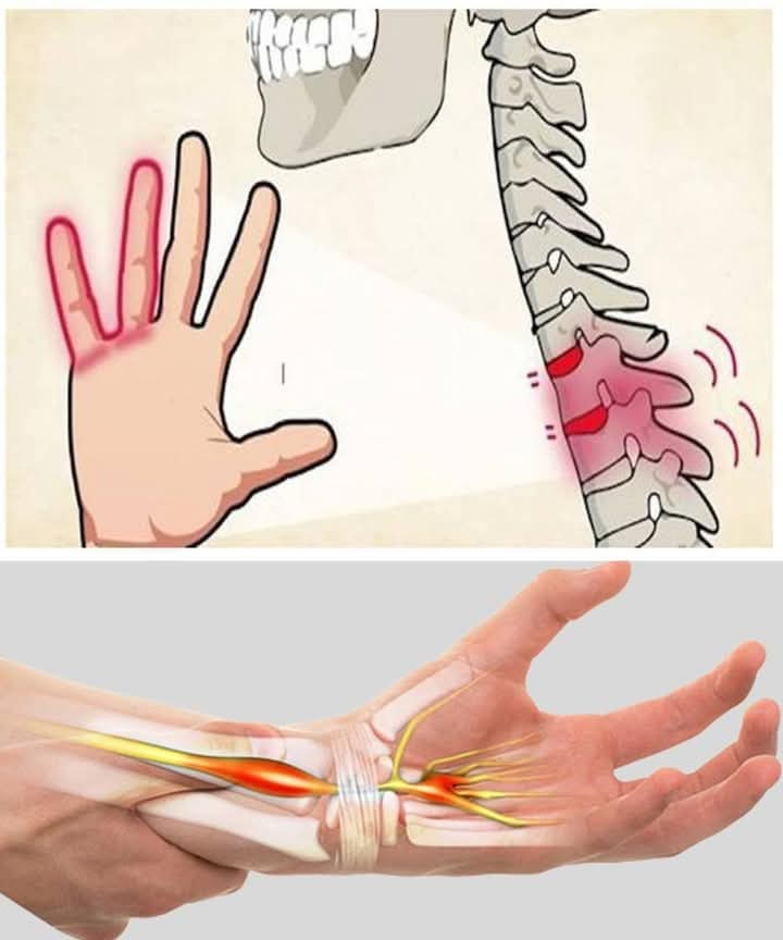 ❤️❤️👉 If your hands fall asleep it is a clear sign that you have c…See more